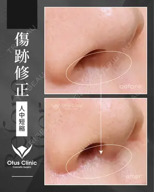 90 days after image