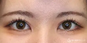 60 days after image