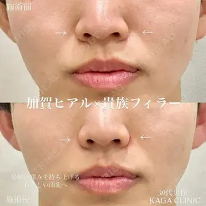 0 days after image