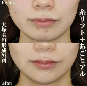 before image