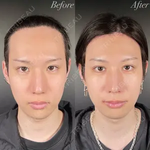 before image