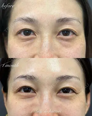 30 days after image