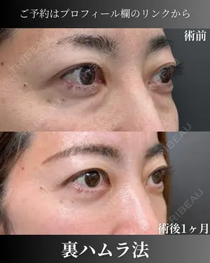 30 days after image