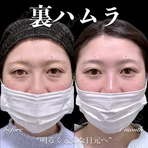 30 days after image