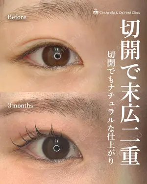 90 days after image