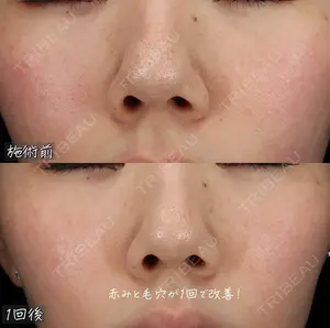 before image