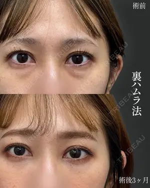 90 days after image
