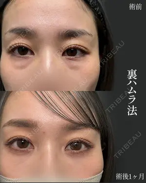 30 days after image