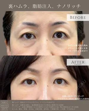 7 days after image