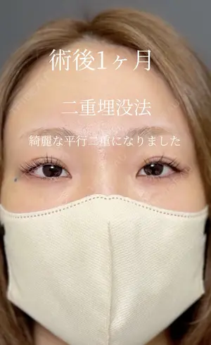 30 days after image