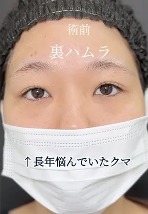 before image