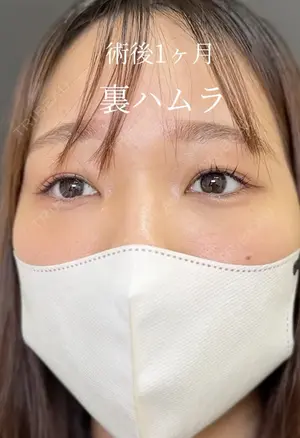 30 days after image