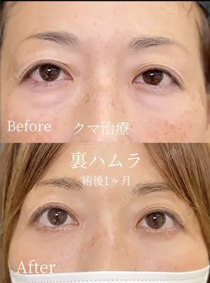 before image