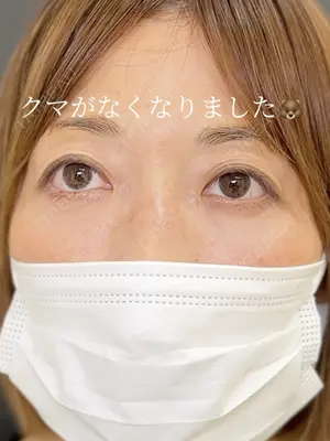 30 days after image