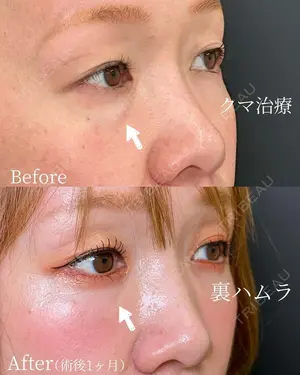 30 days after image