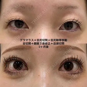 before image
