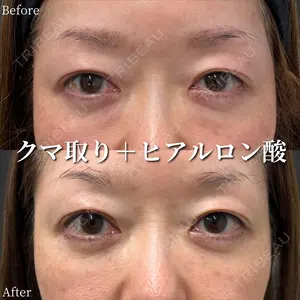 before image