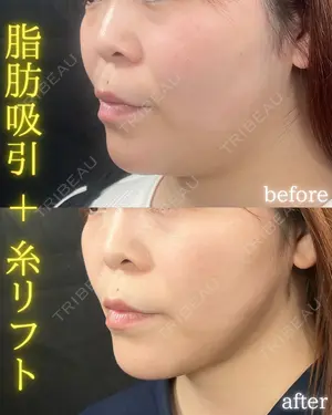 30 days after image