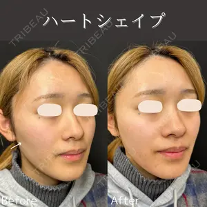0 days after image