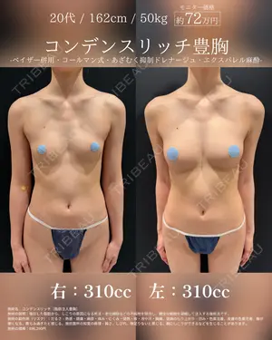 365 days after image