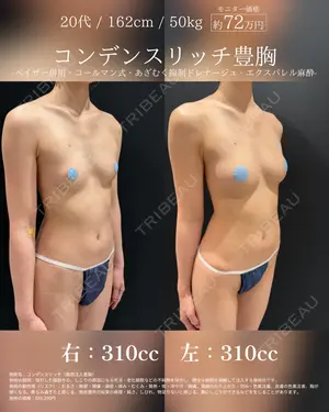 365 days after image