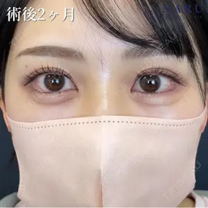 60 days after image