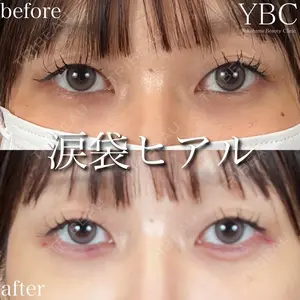 before image