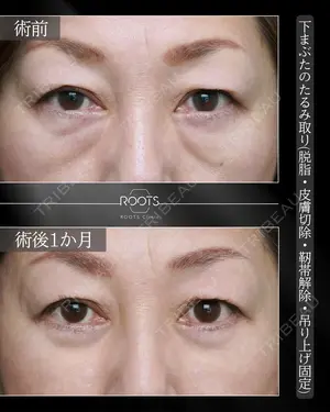 30 days after image