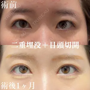 null days after image