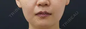 60 days after image