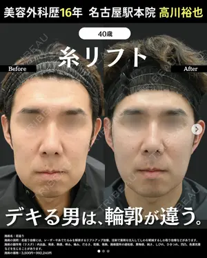 null days after image
