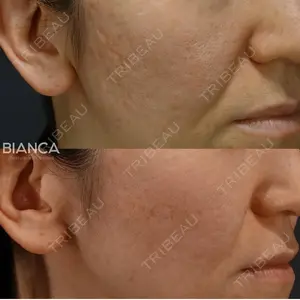 before image