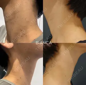 before image