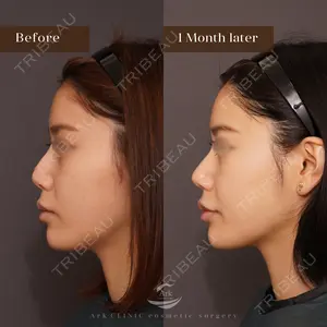 30 days after image