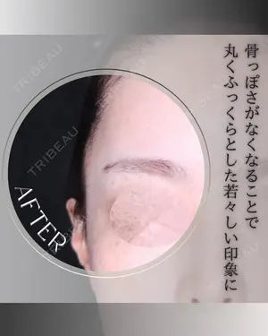 6 days after image