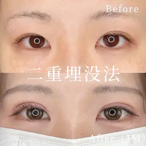 before image