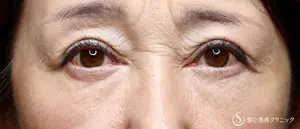 180 days after image