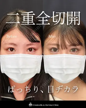 90 days after image