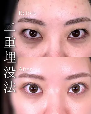 before image