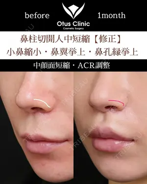 30 days after image