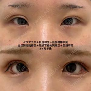 before image