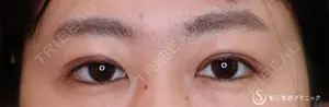 30 days after image