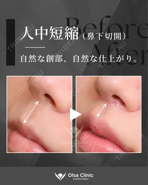 180 days after image