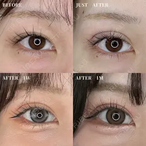before image