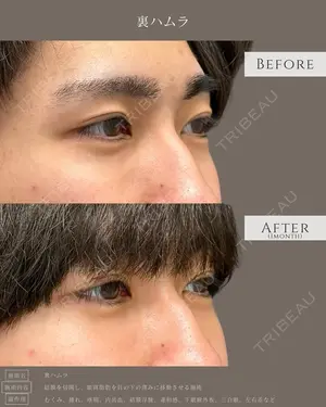 30 days after image