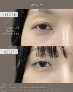 30 days after image