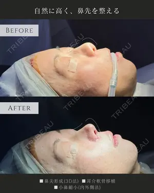0 days after image