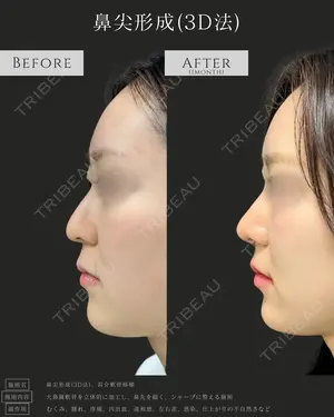 30 days after image
