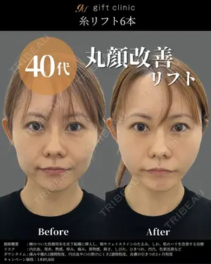 0 days after image