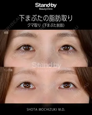 before image